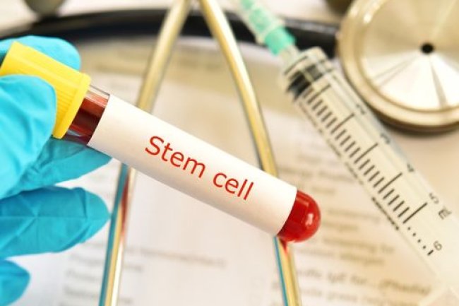 Skeletal muscle-on-a-chip in microgravity as a platform for regeneration modeling and drug screening